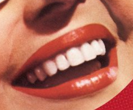 Teeth Whitening Adelaide